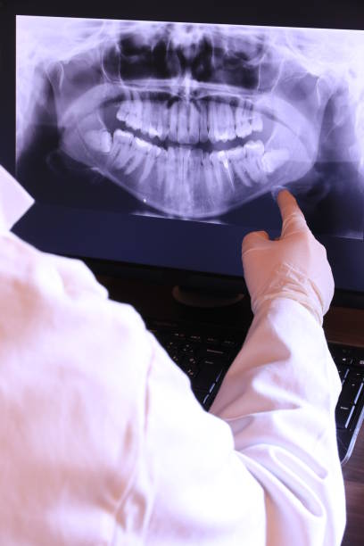 Best Chipped Tooth Repair Near Me  in Tyrone, PA