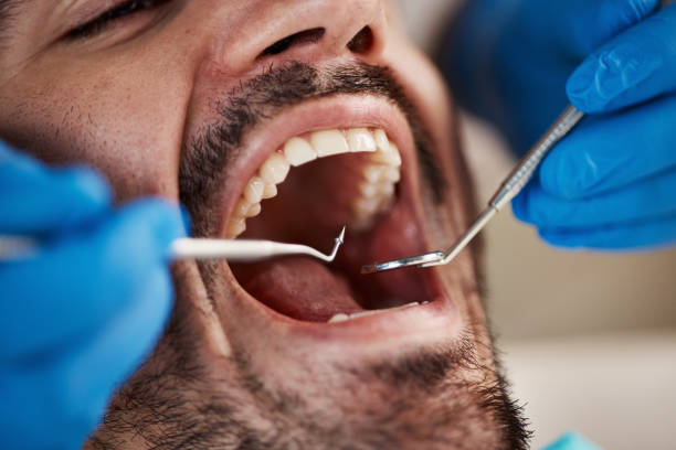 Best Cracked Tooth Emergency Dentist  in Tyrone, PA